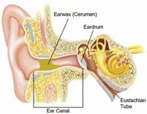 ear-3